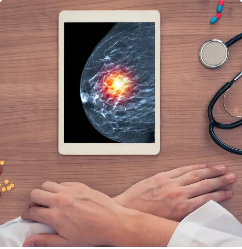 Breast Cancer HER2 Subtype Identification