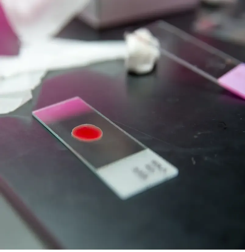 Thalassemia Identification